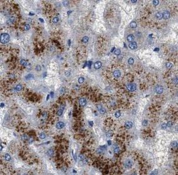 ASGR2 Rabbit Polyclonal Antibody