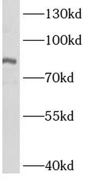 ASH2L Antibody
