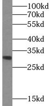 ASRGL1 Rabbit Polyclonal Antibody