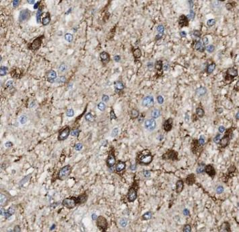 ASRGL1 Rabbit Polyclonal Antibody