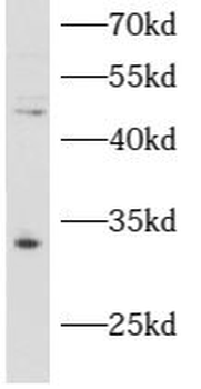ATAD1 Rabbit Polyclonal Antibody