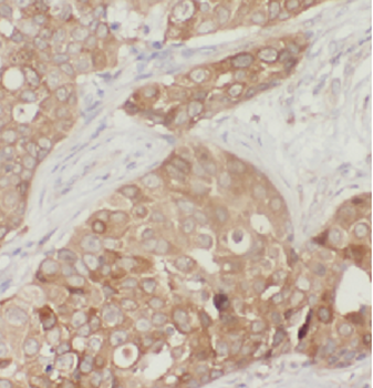 ATF4 Mouse Monoclonal Antibody