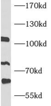 ATF6B Antibody