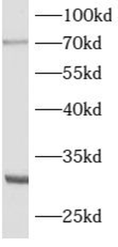 ATG16L2 Rabbit Polyclonal Antibody