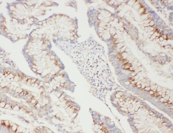 ATG5 Rabbit Polyclonal Antibody