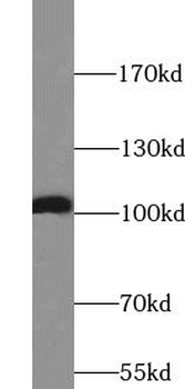 ATP1A1 Rabbit Polyclonal Antibody
