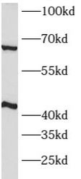 ATP1B2 Antibody