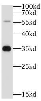 ATP4B Rabbit Polyclonal Antibody