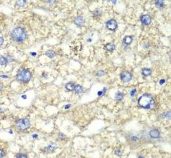 ATP5F1A Rabbit Polyclonal Antibody