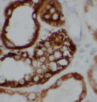 ATP6AP1 Rabbit Polyclonal Antibody