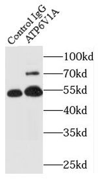ATP6V1A Rabbit Polyclonal Antibody