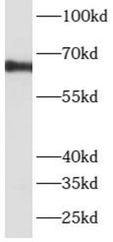 ATP6V1A Rabbit Polyclonal Antibody