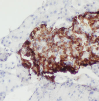 ATP6V1A Rabbit Polyclonal Antibody