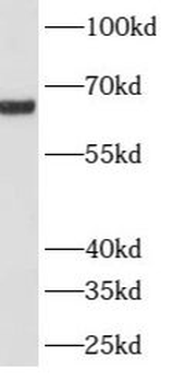 ATP6V1A Rabbit Polyclonal Antibody