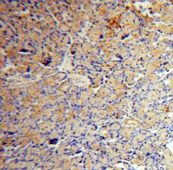 ATP6V1A Rabbit Polyclonal Antibody
