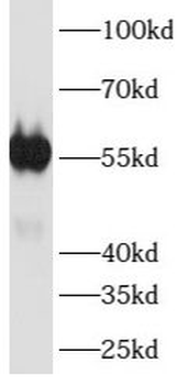ATP6V1B1 Rabbit Polyclonal Antibody