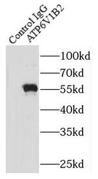 ATP6V1B2 Rabbit Polyclonal Antibody