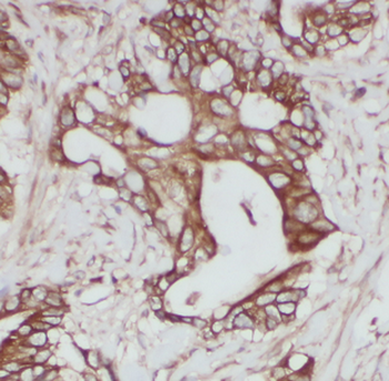 ATP6V1B2 Rabbit Polyclonal Antibody