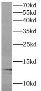 ATP6V1G1 Rabbit Polyclonal Antibody