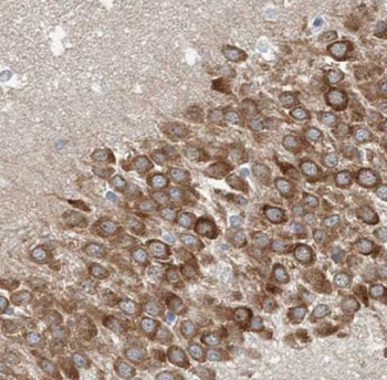 ATP6V1G2 Rabbit Polyclonal Antibody