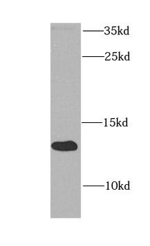 ATP5IF1 Rabbit Polyclonal Antibody