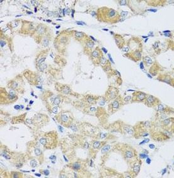 ATP5IF1 Rabbit Polyclonal Antibody