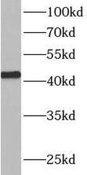 ATXN3L Antibody