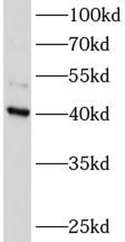 ATXN3L Antibody