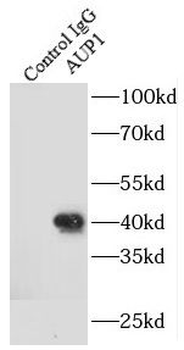 AUP1 Antibody