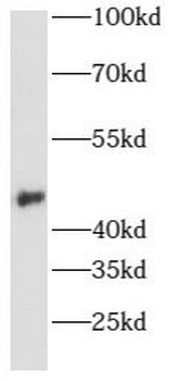 AURKA Rabbit Polyclonal Antibody