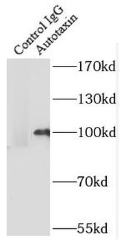 ENPP2 Antibody
