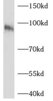 AXIN1 Rabbit Polyclonal Antibody