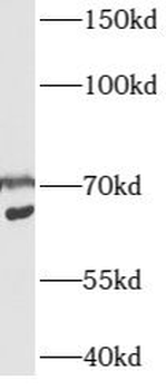 CSRNP1 Rabbit Polyclonal Antibody