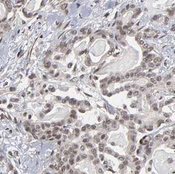 B3GALT4 Rabbit Polyclonal Antibody