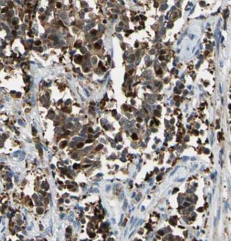 BACH1 Rabbit Polyclonal Antibody