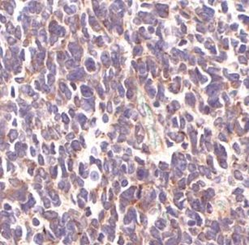 SMARCC2 Rabbit Polyclonal Antibody