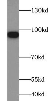SLC4A1 Rabbit Polyclonal Antibody