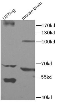 SLC4A1 Rabbit Polyclonal Antibody