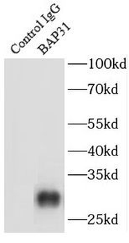 BCAP31 Rabbit Polyclonal Antibody