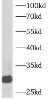 BCAP31 Rabbit Polyclonal Antibody