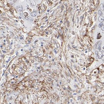 BCAP31 Rabbit Polyclonal Antibody