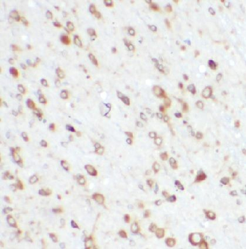 BBS1 Antibody