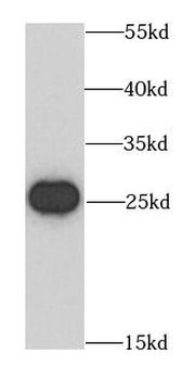 BCAS2 Rabbit Polyclonal Antibody