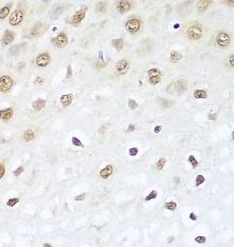 BCAS2 Rabbit Polyclonal Antibody