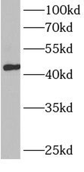 BCAT1 Rabbit Polyclonal Antibody