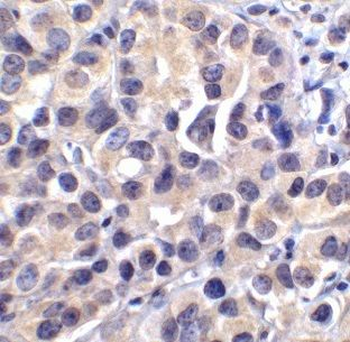 BCAT1 Rabbit Polyclonal Antibody