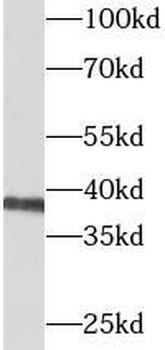 BCAT2 Rabbit Polyclonal Antibody