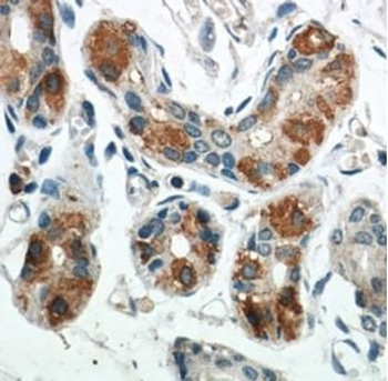 BCAT2 Rabbit Polyclonal Antibody
