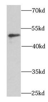 BCCIP Rabbit Polyclonal Antibody