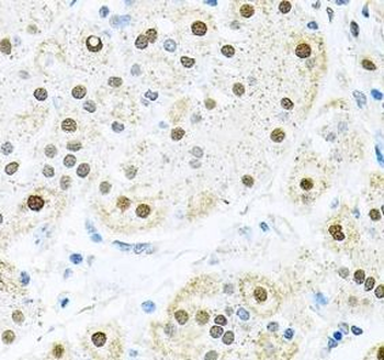 BCCIP Rabbit Polyclonal Antibody